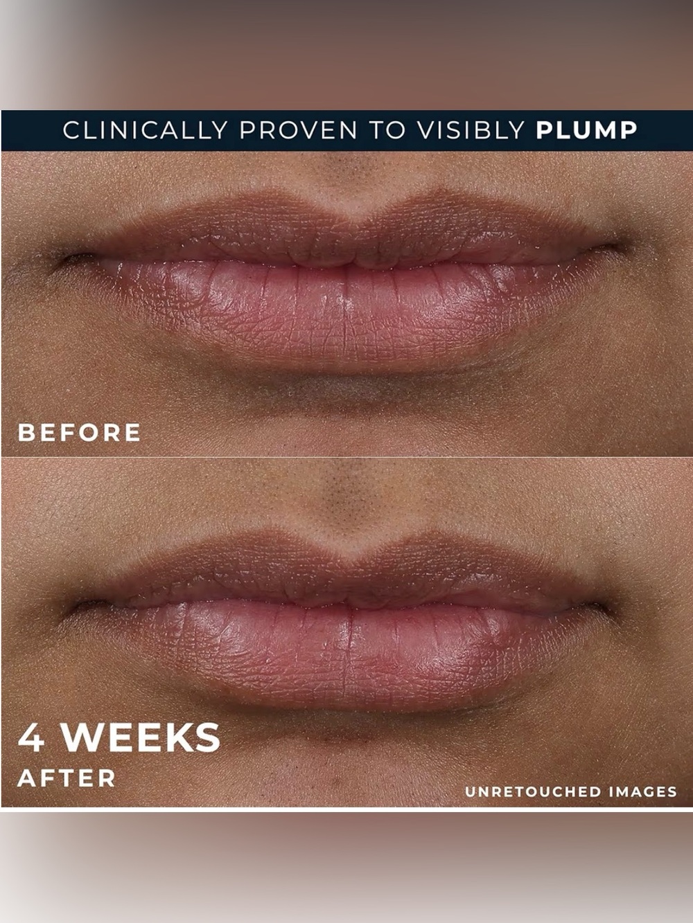 RoC Lip Volumizer Treatment Collagen Peptides + Hyalauronic Acid | NEW - Picture 5 of 7